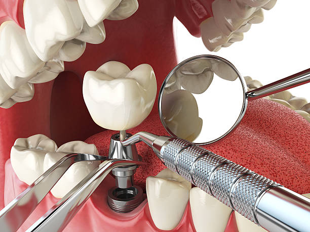 Best Cosmetic Emergency Dentistry in Ambridge, PA